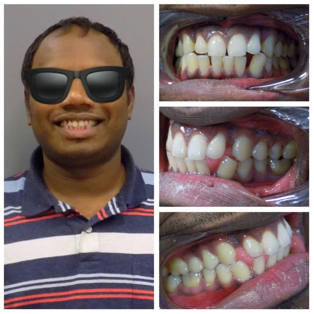 Cosmetic Dentist in Weymouth